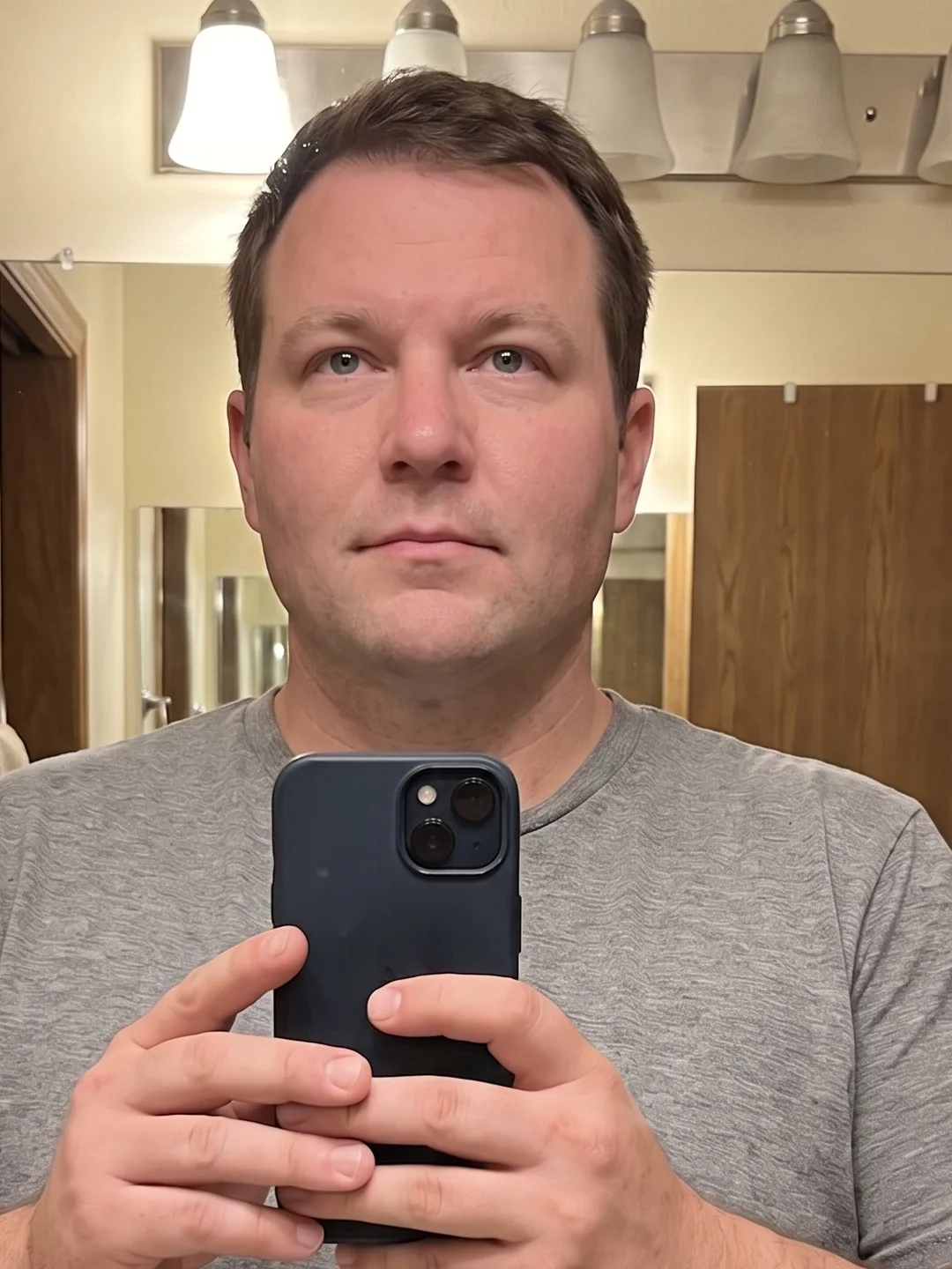 AI example visualization of a healthy, slimmer face after gradual weight loss